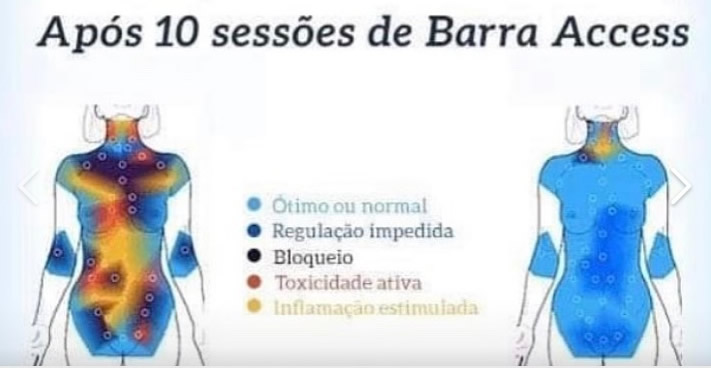 10 sessões